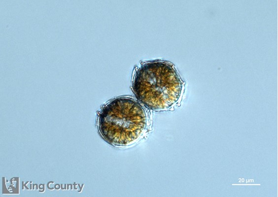 Photo of Alexandrium catenella